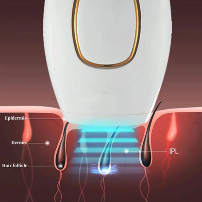 Depiladora IPL Láser – Tecnología Profesional de Depilación en Casa